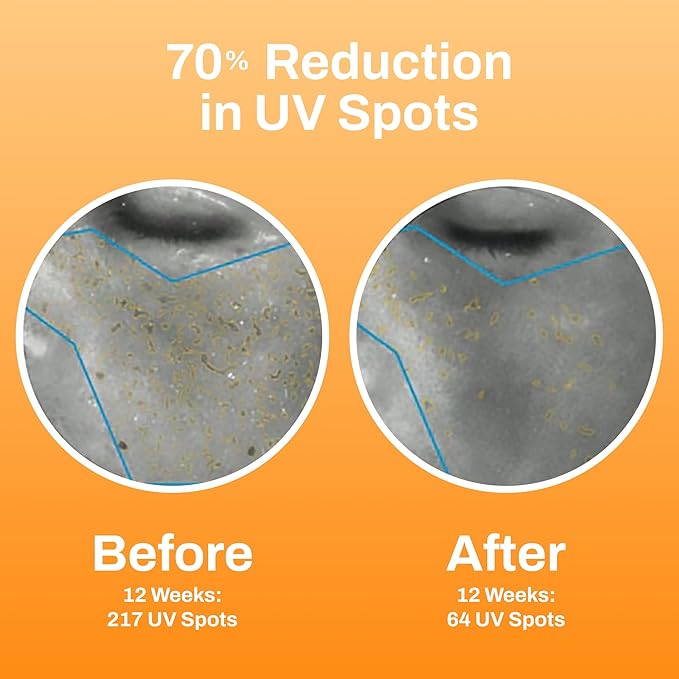 Photozyme GFS Plus Night Serum with 0.3% Retinol and Bakuchiol – Gentle Anti-Aging Peptide Formula – Reduces Wrinkles, Sun Damage & Dark Spots – Firms, Brightens & Smooths Skin – 1.7 fl oz