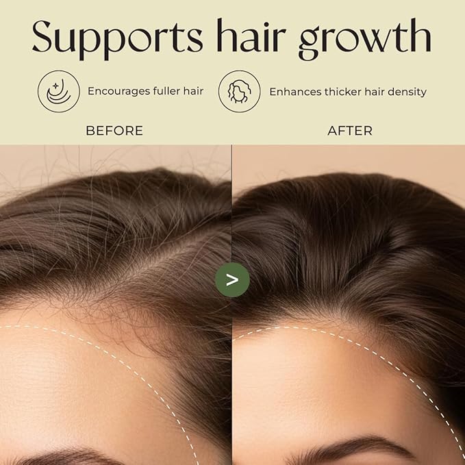 Gya Labs Rosemary & Castor Hair Growth & Styling Oil - 4 Fl Oz - Rosemary to Strengthen Hair - Protect & Tame Frizz, Dry Scalp - Hair & Scalp Hydration with 0.17 Fl Oz Deep Revival Argan Oil