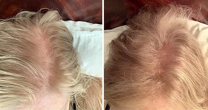 Hair Building Fibers. Cover Bald Spot and Thinning Hair. All-Natural, Plant-Based (Trial Size, 10-Day Supply). Golden Blonde