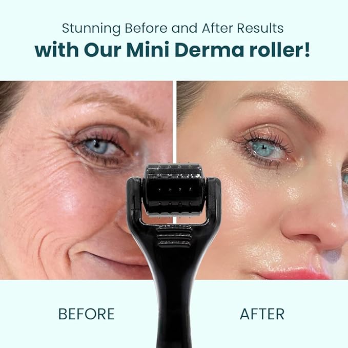 Gin Amber Beauty Mini Derma roller (0.25mm) - 48 Real Individual Needles, Microdermabrasion Device for Skin Care, Serum Absorption with Microneedling, Tool, Hygienic Case (Black Mini 0.25mm)