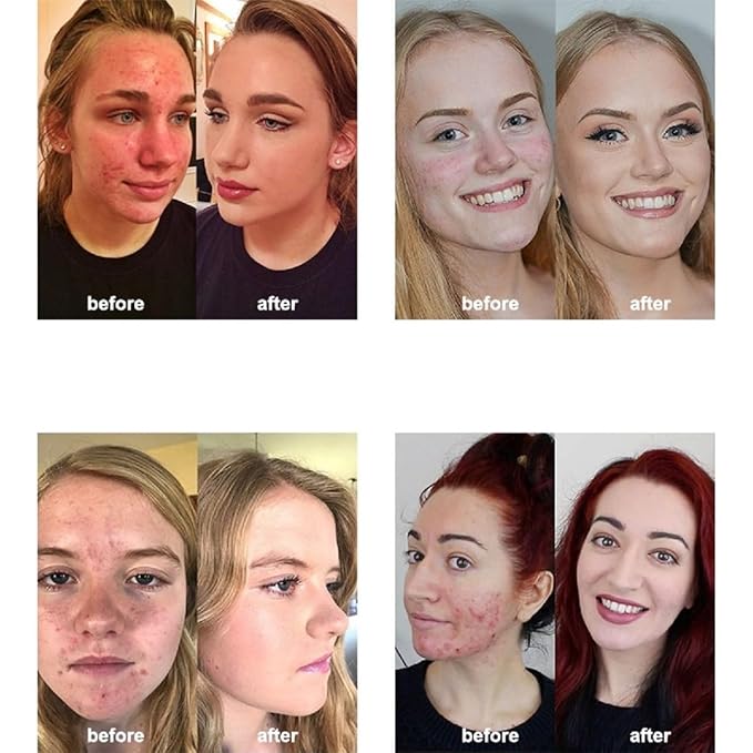 2 Pack PHOERA Foundation 104 Buff Beige Makeup,Full Coverage Foundation for Women and Girls