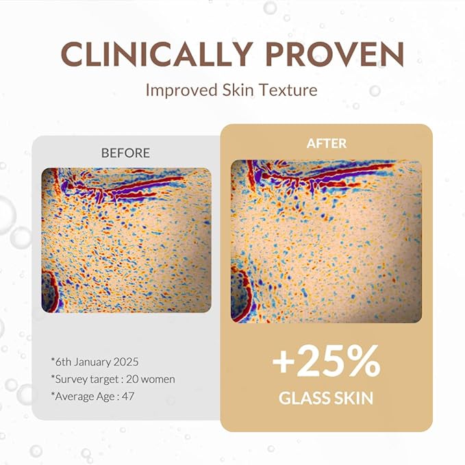 MIZON Snail Repair Intensive Ampoule with Snail Mucin, Hyaluronic Acid & Vitamin E – Hydrating & Wrinkle Care Serum for Skin Elasticity & Repair (1.01 fl oz)