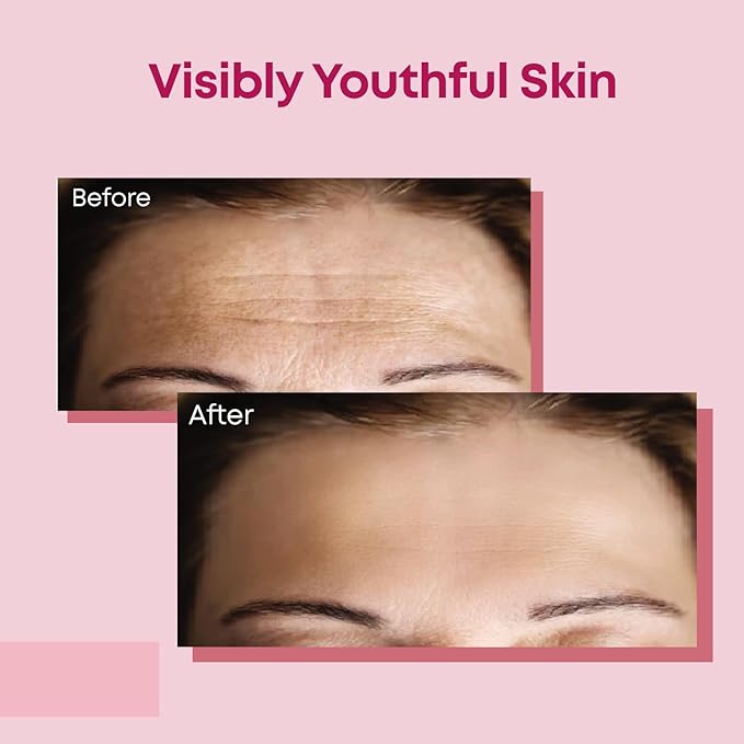 Forehead Wrinkle Patches | Anti-Wrinkle Facial Patches for Fine Lines | Overnight Wrinkle Filler & Deep Line Treatment | Disposable Face Tape for a Youthful, Firmer, and Smoother Appearance | 20 Count