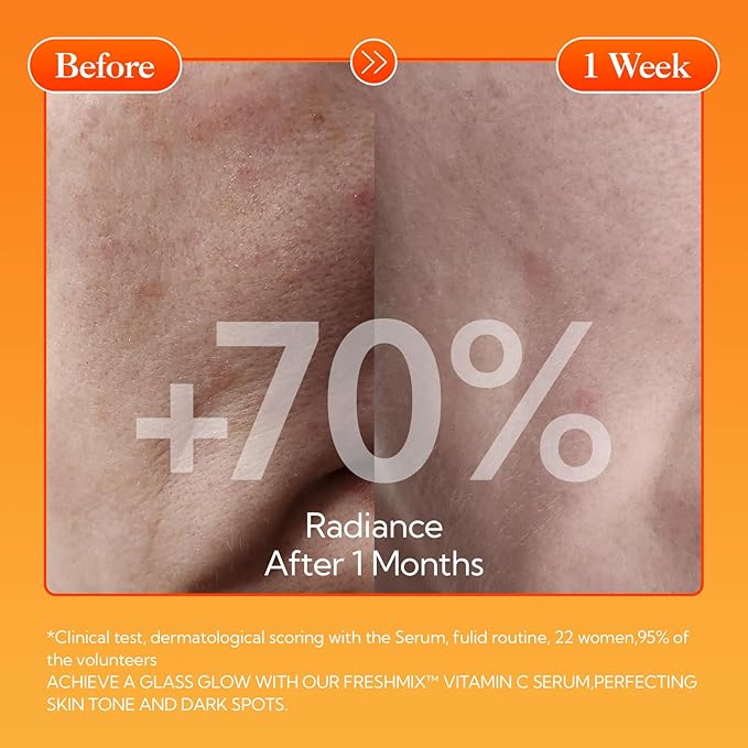 LANBENA Revolutionary Vitamin C Tablets Serum for Face, Illuminating Fcae Serum With Niacinamide, Brightening Anti-Aging Essence for Sensitive Skin, Non-Greasy, Reduces Dark Spots & Wrinkles (1.05 Oz)