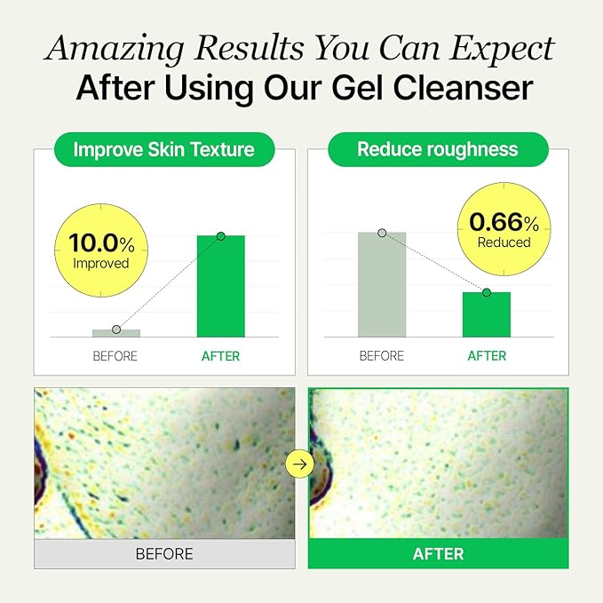 Gel Cleanser, Big Size, Gentle Exfoliation and Face cleanser for Sensitive Skin, Korean Skin Care, Vegan, 6.93 Fl Oz