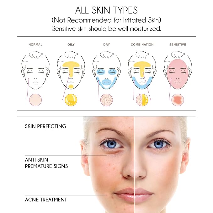 Pure Vitamin C Facial Serum with Salicylic Acid and Glycolic Acid, Anti-Wrinkle, Anti-Acne and Anti-Blackhead, Dark Spot Correcting, 7,5% AHA, Sebum Balance, ¾ oz