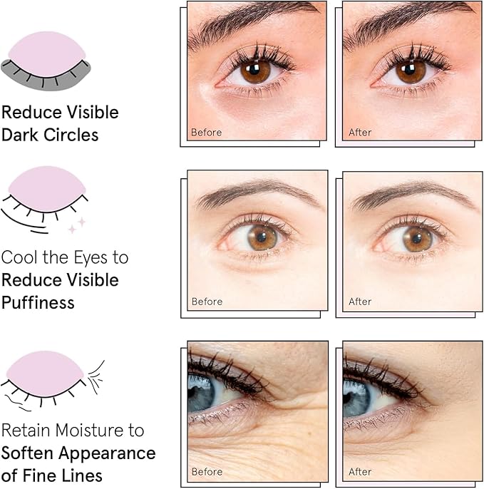 grace & stella Award Winning Under Eye Mask Reduce Dark Circles, Puffy Eyes, Undereye Bags, Wrinkles, Gel Under Eye Patches, Nurse Gifts, Vegan Cruelty-Free Self Care (6 Pairs, Blue)