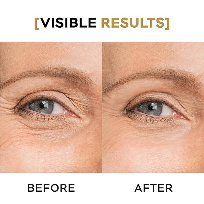 Moisturizing Eye Cream w/Aloe Vera, Collagen, Hyaluronic Acid, Cotton Stem Cells for Dark Circles, Puffiness & Bags - Under Eye Hydration Cream for Women & Men (1 Fl Oz)