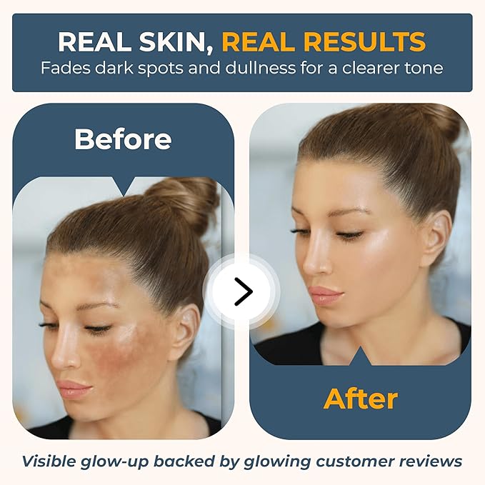 Vitabri Vitamin C Serum for Face – Brightening & Anti-Aging Formula with Vitamin C, Ferulic Acid & Botanicals – Hydrating Serum for Dark Spots, Tone & Fine Lines – 1 Fl Oz