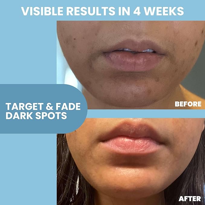 Eva Naturals Niacinamide 12% + Zinc Serum for Face – Dark Spot Remover, Pore Minimizer, Redness Relief, Hydrating Vitamin B3 with Botanical Hyaluronic Acid, Anti-Aging Serum for Clear Skin (2 Pack)