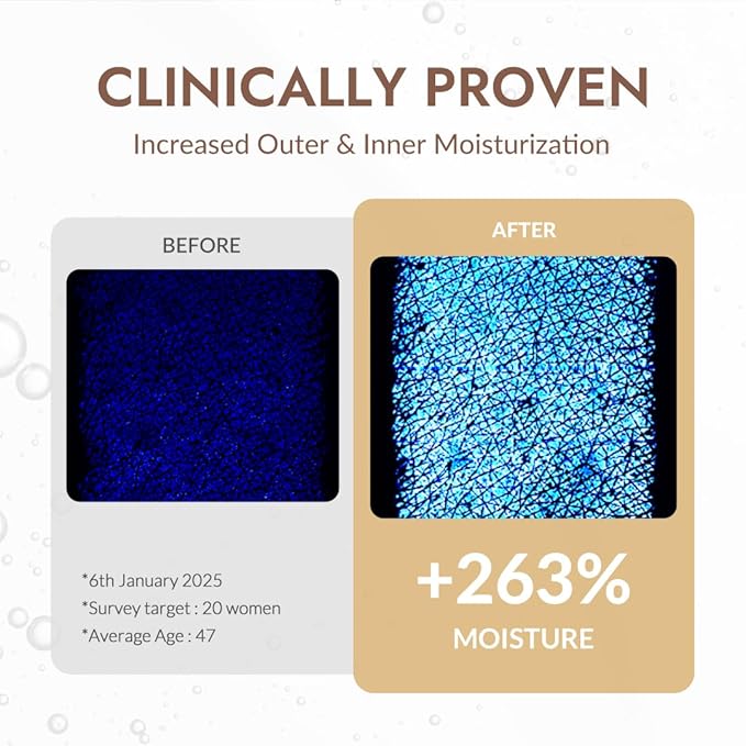 MIZON Snail Repair Intensive Ampoule with Snail Mucin, Hyaluronic Acid & Vitamin E – Hydrating & Wrinkle Care Serum for Skin Elasticity & Repair (1.01 fl oz)