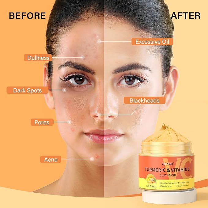 Turmeric Vitamin C Clay Mask -Turmeric Facial Mask - Brightening Clay Face Mask Skincare, Deep Cleansing Face Mask, Acne Face Mask for for Dark Spots, Dull Skin, Refining Pores and Controlling Oil