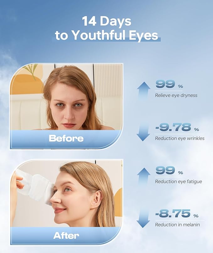 Hyaluronic Acid Self Heating Warm Compress for Eyes, Heated Eye Mask for Fast Relief of Dry Eyes, 14 Pack Steam Eye Mask, Moisturizing & Highly Effective Steam Eye Mask