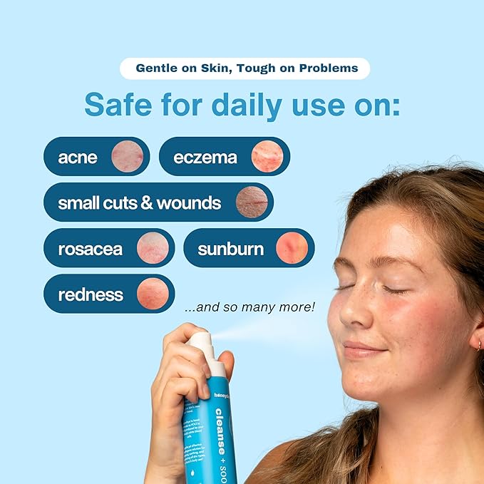 Hypochlorous Acid Spray – HOCl Face & Body Mist for Acne, Eczema & Irritation – Multi-Purpose Skin Repair – Eyelid Cleanser, Post-Workout/Procedure, Scalp & Sensitive Skin (2 oz+6.8 oz)