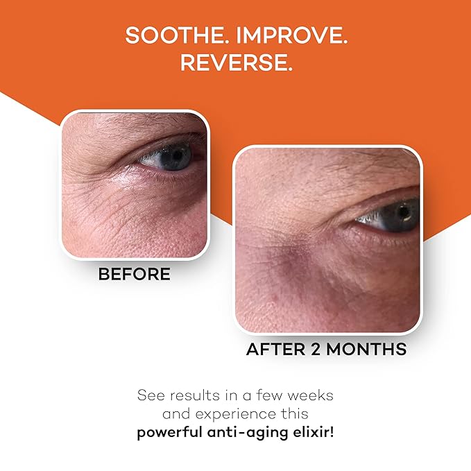 Zocufill Elixir Eye Gel and Face Serum - Eye Bags Treatment for Women and Men - Reduce the Appearance of Dark Circles, Puffy Eyes, Fine Lines and Wrinkles