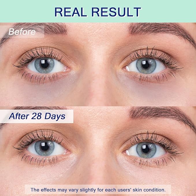 Eye Serum for Dark Circles, 5% Caffeine Under Eye Cream for Wrinkles, Morning Puffiness and Fine Lines, Deeply Repairs the Muscles Around the Eyes with 360°Massage Ball, 0.5 Fl Oz