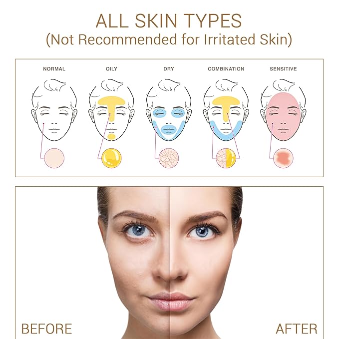 Niacinamide with Salicylic Acid Serum for Face, Hydrating Dark Spot Facial Serum & Plumb Skin, Daily Skincare Essential, 1 fl. oz, Made in Europe