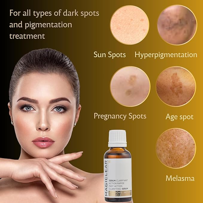 Luxury Swiss Dark Spot Remover for Face and Body Serum Gel Cream Age Sun Brown Spot Acne Freckles Corrector Melasma treatment Anti aging Skin Vitamin C + Niacinamide best organic brand Magiclear