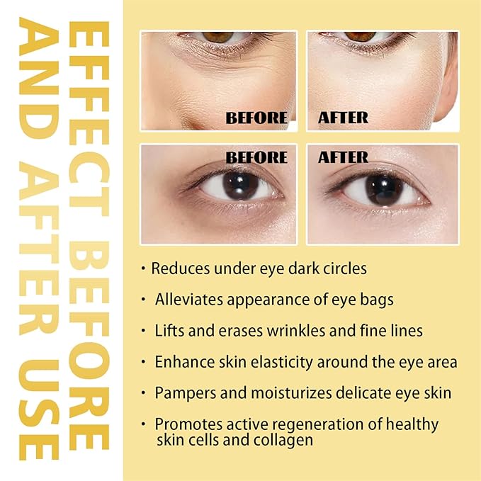 Time Eraser Rollerball Castor Oil and Frankincense, Time Eraser Rollerball, Castor Oil and Frankincense Eye Roller for Reducing Dark Circles and Bags Under Eyes