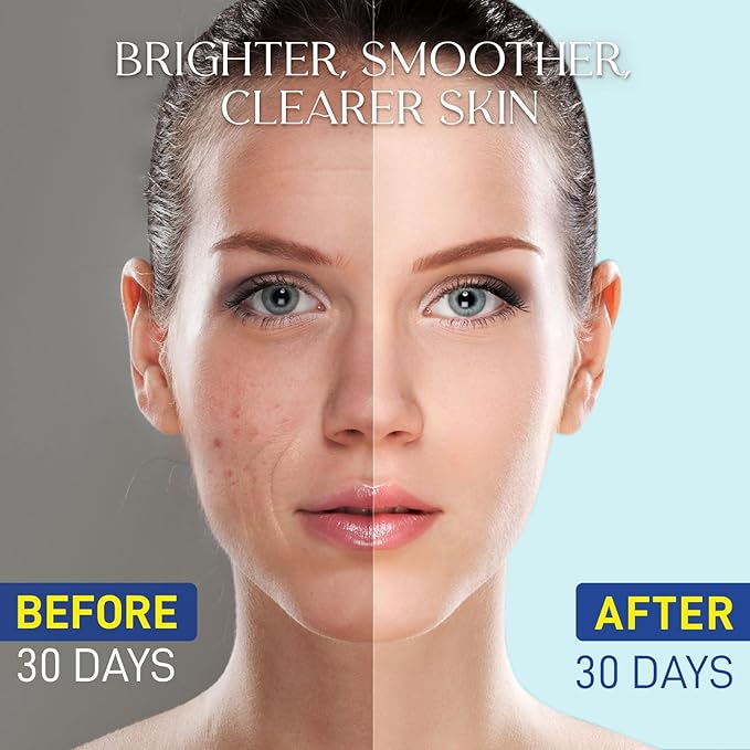 Niacinamide Serum 15% for Face – Dark Spot Corrector, Pore Minimizer, Oil & Blemish Control, Brightening & Hydrating with Vitamin C, B5, Peptides & Hyaluronic Acid – 1.7 Fl Oz