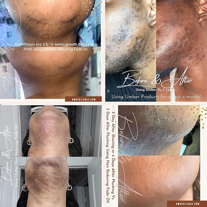 Hair Reducing Fade Oil – Regular Strength (Not sensitive skin), Minimizes Hair Growth for Face & Body – For Women & Men – 15ml Serum