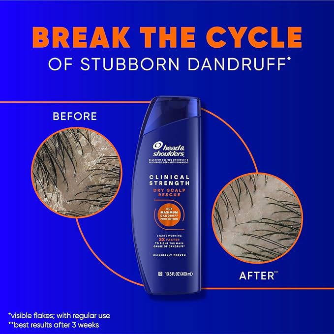 Head & Shoulders Clinical Strength Dandruff Shampoo and Conditioner Set, Dry Scalp Relief, Up to 100% Flake Protection, Selenium Sulfide Formula, 13.5 & 9.1 Fl Oz, 2 Pack