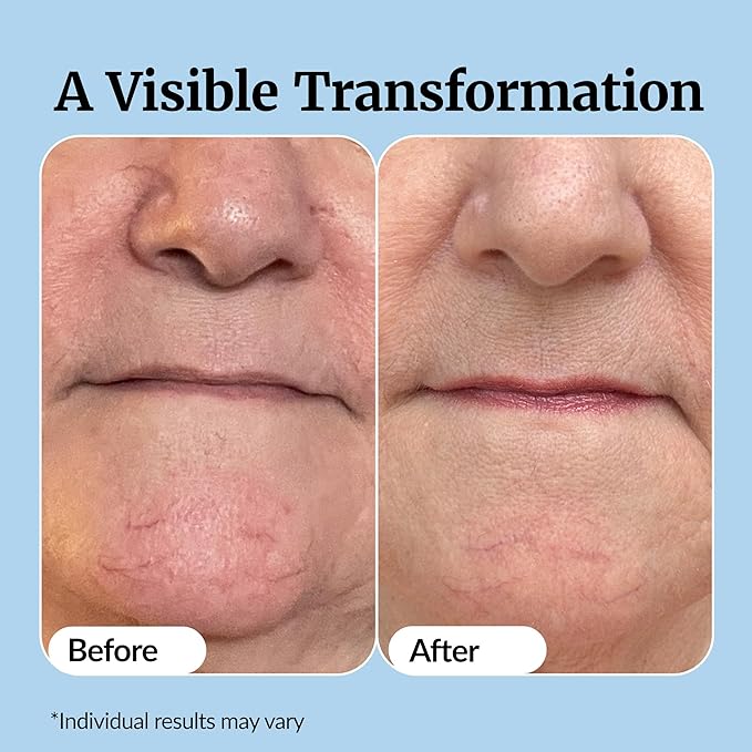 Vibriance Super C Serum for Mature Skin - All-in-One Vitamin Formula Hydrates, Firms, Lifts, Smooths, Targets Age Spots, Wrinkles, 1 fl oz