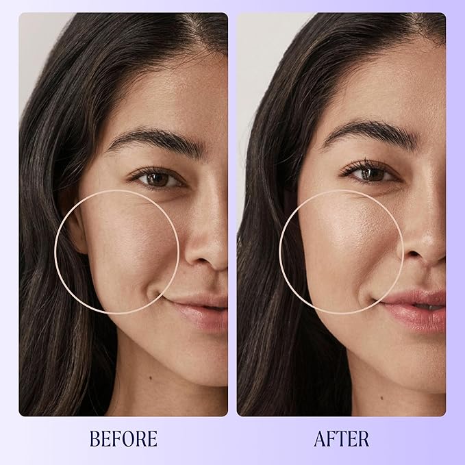 Kinship Zinc Oxide Mineral Sunscreen for Face Self Reflect SPF 32 | Vegan, Reef Safe, Non Toxic Eczema Sunscreen for Sensitive Skin | Sunblock Face Moisturizer with SPF (3.5 oz)