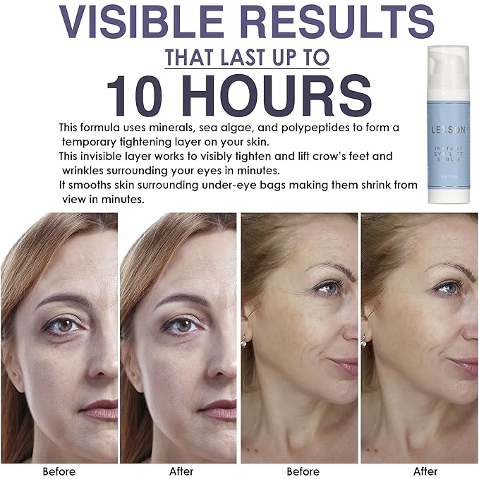 Instant Eye Lift Serum - Provides Immediate Visible Results, Lifts Away Appearance of Lines & Wrinkles. Dark Circles Under Eye Treatment, Eye Cream for Dark Circles and Puffiness
