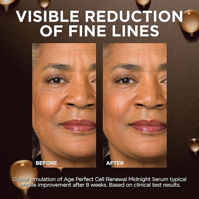 L'Oreal Paris Age Perfect Anti-Aging Midnight Face Serum, Reduce Wrinkles 1oz + Eye Cream Sample