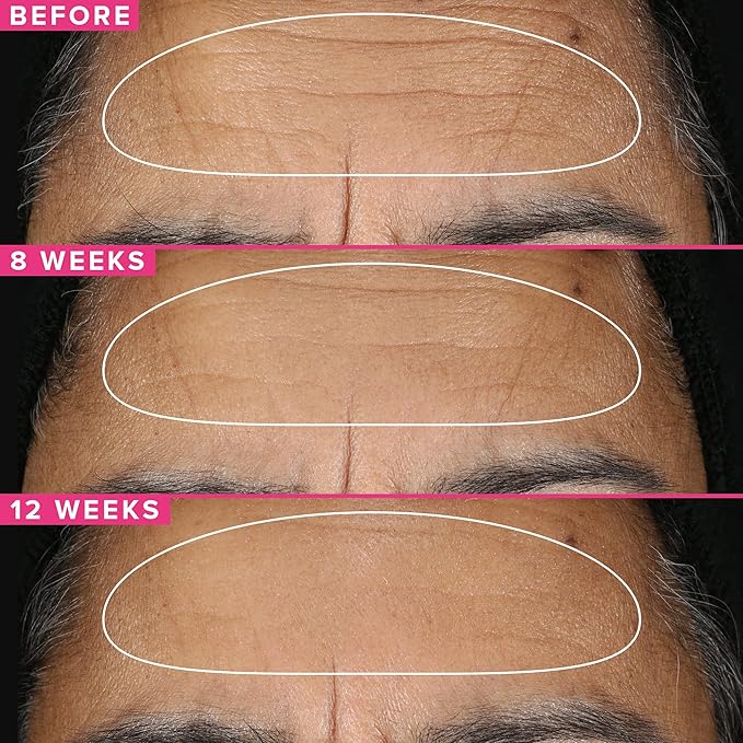 Farmacy Retinol Serum for Face - 1% Vitamin A Anti Aging - Resurfacing Wrinkle Formulated with Encapsulated Retinol + Ceramide NP to Prevent Moisture Loss + Replenish Skin Barrier (30ml)